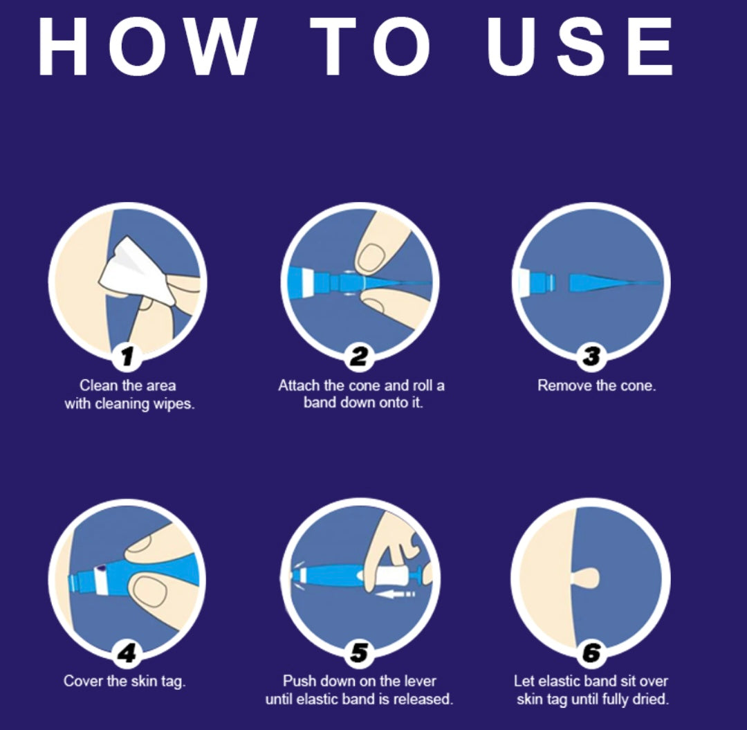 Skin Tag Removal Kit