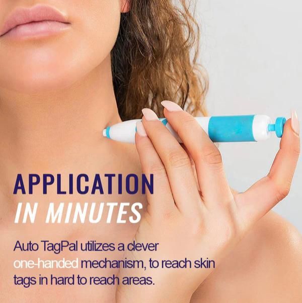Skin Tag Removal Kit
